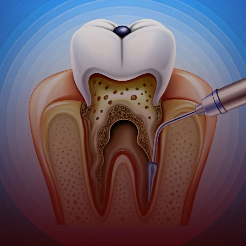 افضل عيادة لعلاج جذور الأسنان في سوريا حلب